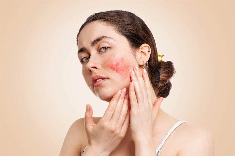 Sensitivities and Allergies: What's in Your Skincare Products?